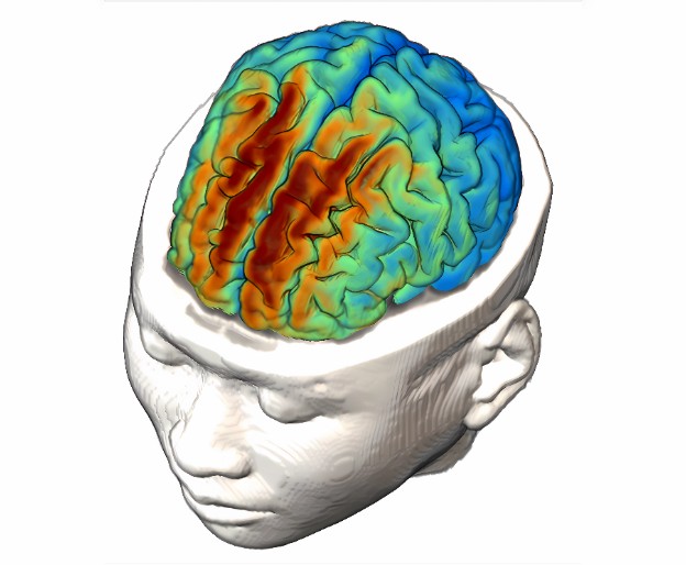 depicts electrical current being distributed across the brain during transcranial direct current stimulation.